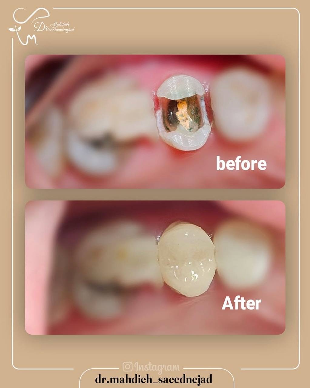 مهدیه سعیدنژاد