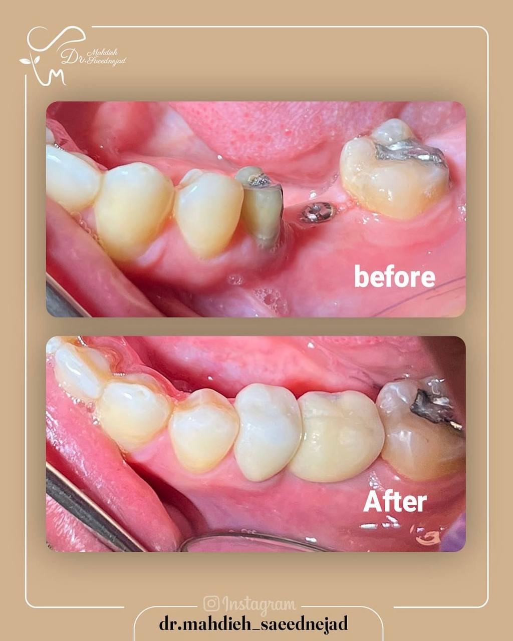 مهدیه سعیدنژاد