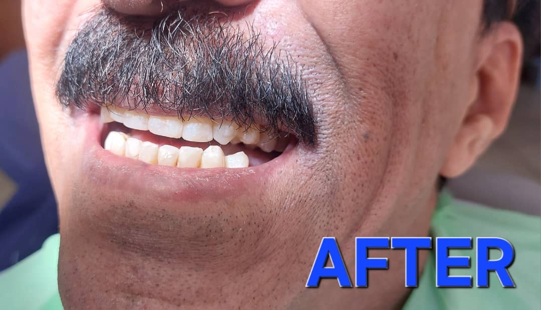 نازی برهنه پوشان