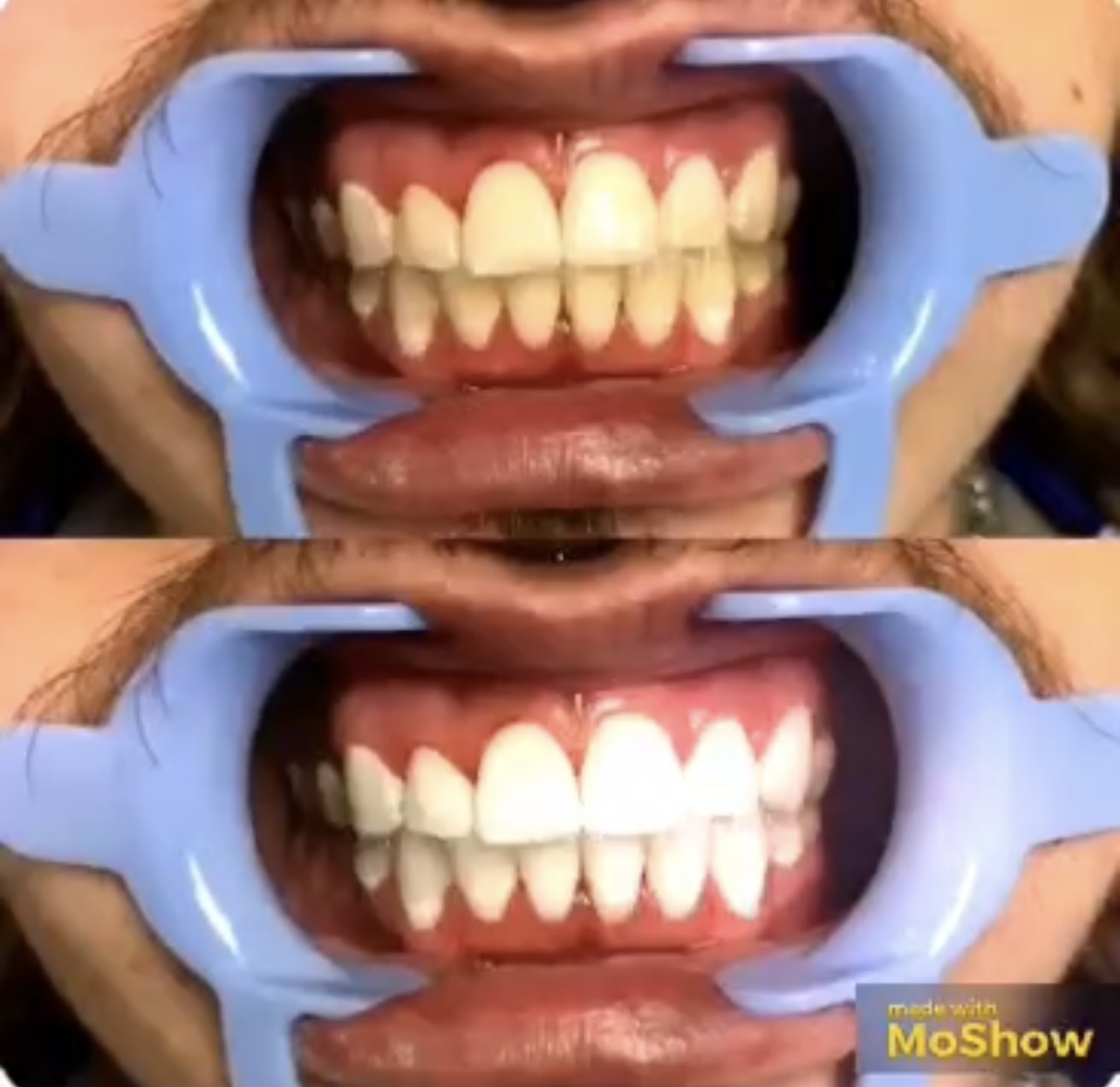 نازی برهنه پوشان