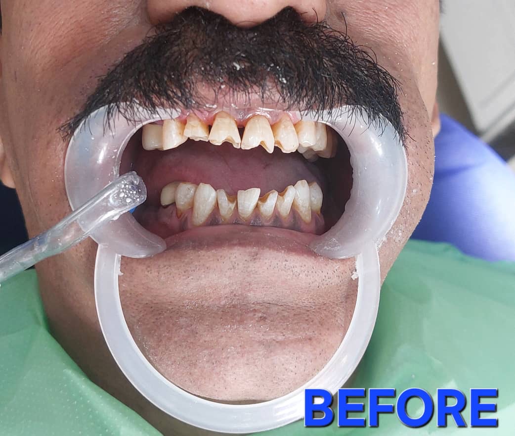 نازی برهنه پوشان